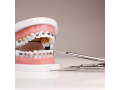 best-orthodontist-in-dubai-small-0