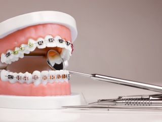 Best orthodontist in Dubai