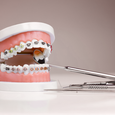 best-orthodontist-in-dubai-big-0