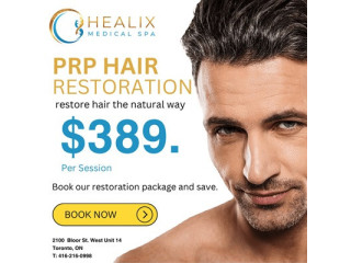 PRP Hair Restoration for Men in Toronto, ON