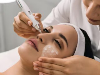 Blackhead Treatment In Surrey