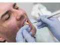 affordable-and-professional-dental-clinics-in-cote-des-neiges-small-0