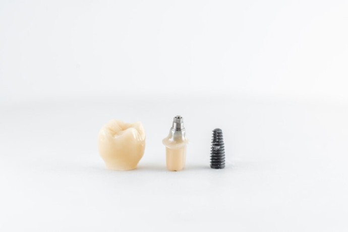 best-dental-crowns-in-calgary-restore-your-smile-big-0