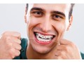 orthodontic-treatment-in-calgary-straighten-your-smile-with-expert-care-small-0