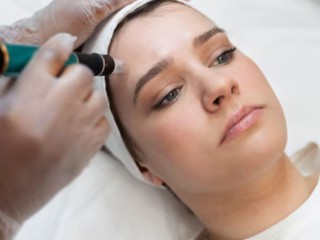 HydraFacial Treatment for Acne