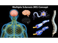 chronic-challenges-multiple-sclerosis-and-the-central-nervous-system-small-0