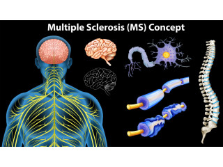 Chronic Challenges: Multiple Sclerosis and the Central Nervous System