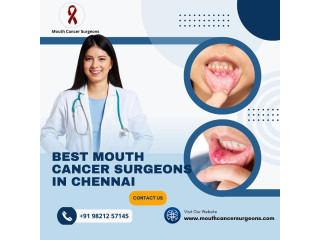 Mouth Cancer Specialist Chennai | Mouth Cancer Surgeons