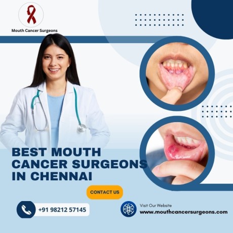 oral-cancer-treatment-in-chennai-mouth-cancer-surgeons-big-0