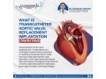 best-tavr-expert-in-jaipur-dr-prashant-dwivedi-small-0