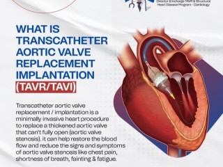 Best TAVR Expert in Jaipur - Dr. Prashant Dwivedi