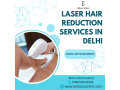 laser-hair-reduction-in-delhi-small-0