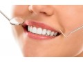 online-dentist-appointment-in-baruipur-small-0