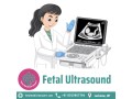 fetal-ultrasound-in-lucknow-small-0