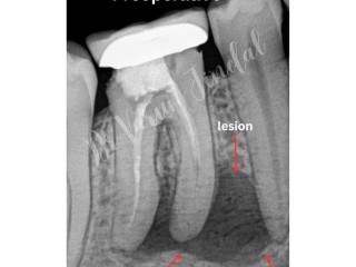 The Importance of Dental Visits in Panchkula