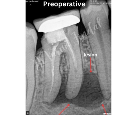 the-importance-of-dental-visits-in-panchkula-big-0