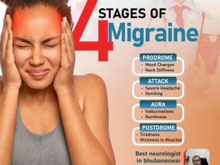 Trusted Migraine Treatment Doctor in Bhubaneswar: Relief & Care