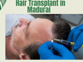 Dandruff Treatment in Madurai | Renew Plus for healthy hair