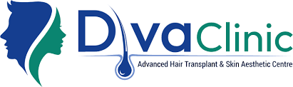 hair-transplant-and-replacement-in-lucknow-diva-clinic-big-0