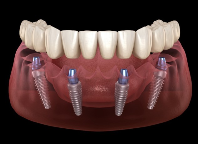 restoring-your-smile-and-confidence-big-0