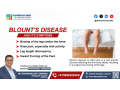 blounts-disease-and-its-symptoms-small-0