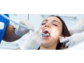 root-canal-treatment-prices-in-delhi-small-0