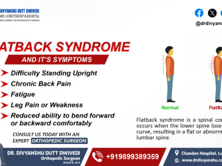 Flatback Syndrome: Key Symptoms to Recognize