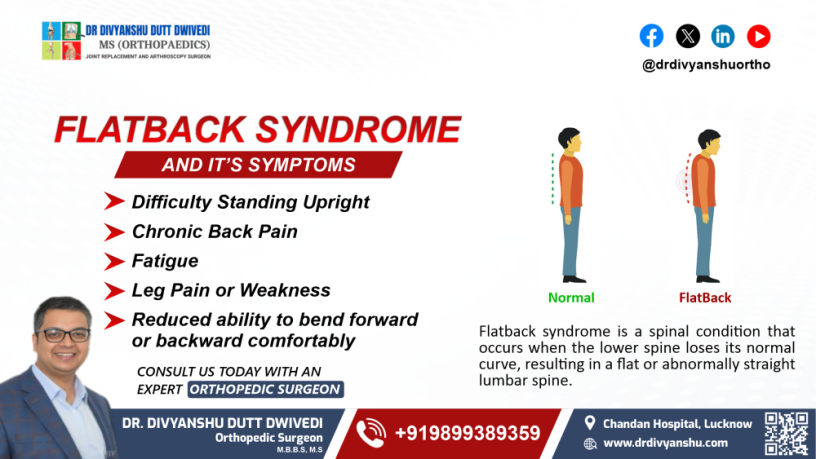 flatback-syndrome-key-symptoms-to-recognize-big-0