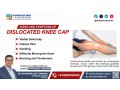 signs-and-symptoms-of-a-dislocated-knee-cap-small-0