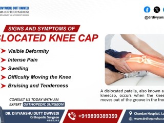 Signs and Symptoms of a Dislocated Knee Cap