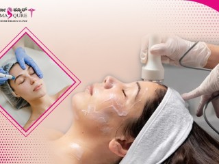 Best Hydrafacial Treatment in Bangalore at Dermaqure