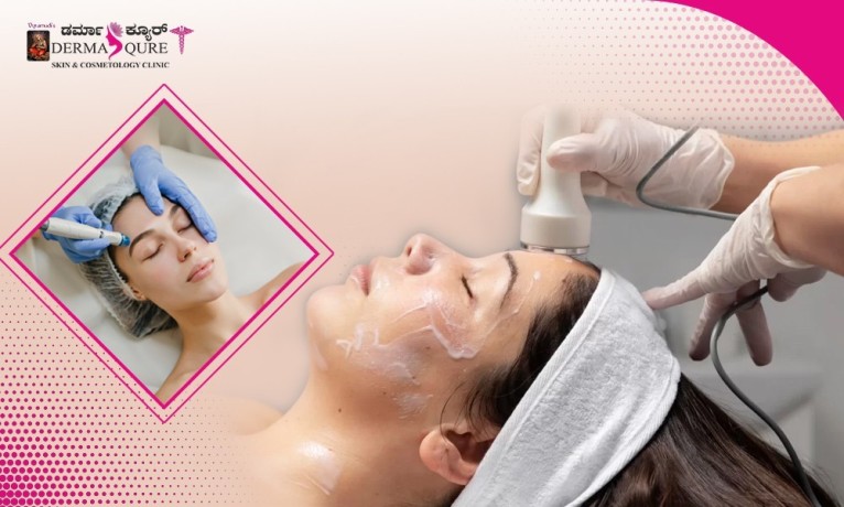 best-hydrafacial-treatment-in-bangalore-at-dermaqure-big-0