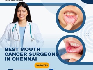 Oral Cancer Treatment Doctors In Chennai | +91 96633 03747