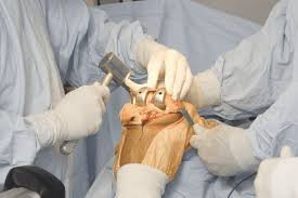 best-knee-replacement-surgeon-doctor-in-madurai-big-2