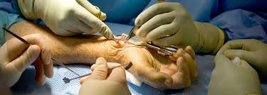 best-knee-replacement-surgeon-doctor-in-madurai-big-3