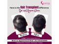hair-transplant-clinic-in-bhubaneswar-small-1