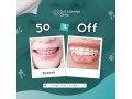 teeth-clip-treatment-in-coimbatore-small-0