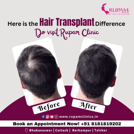 rupam-clinic-best-hair-transplant-clinic-in-bhubaneswar-big-0