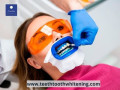 painless-teeth-whitening-everbrite-teeth-whitening-small-0