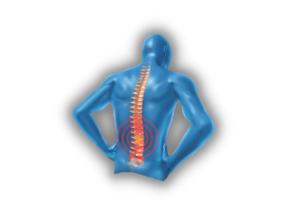 Physical Therapy for Back Pain: Effective Solutions for Relief and Recovery