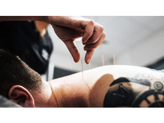 Experience the Best Acupuncture in Austin