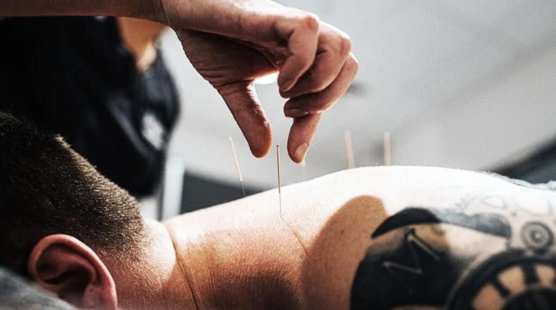 experience-the-best-acupuncture-in-austin-big-0