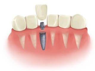 McClane Dentistry