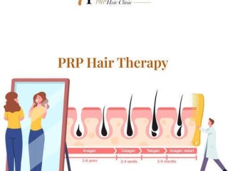 Platelet Rich Plasma Hair Therapy