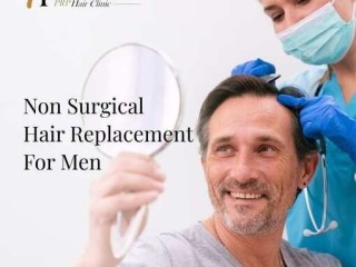 Men hair replacement