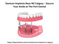 denture-implants-near-ne-calgary-secure-your-smile-at-the-port-dental-small-0