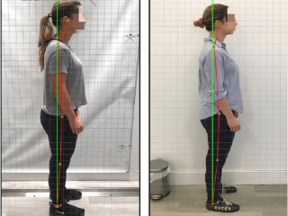 Posture Correction for Upper West Side NYC