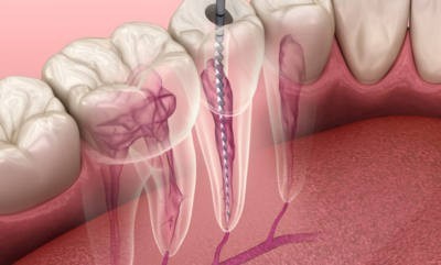 symmetry-vascular-center-big-3