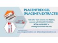 placentrex-gel-for-chronic-non-healing-wounds-available-now-at-onlinegenericmedicine-small-0