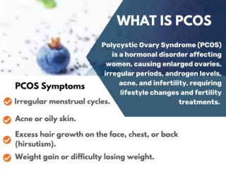 Polycystic Ovarian Syndrome Treatment in USA